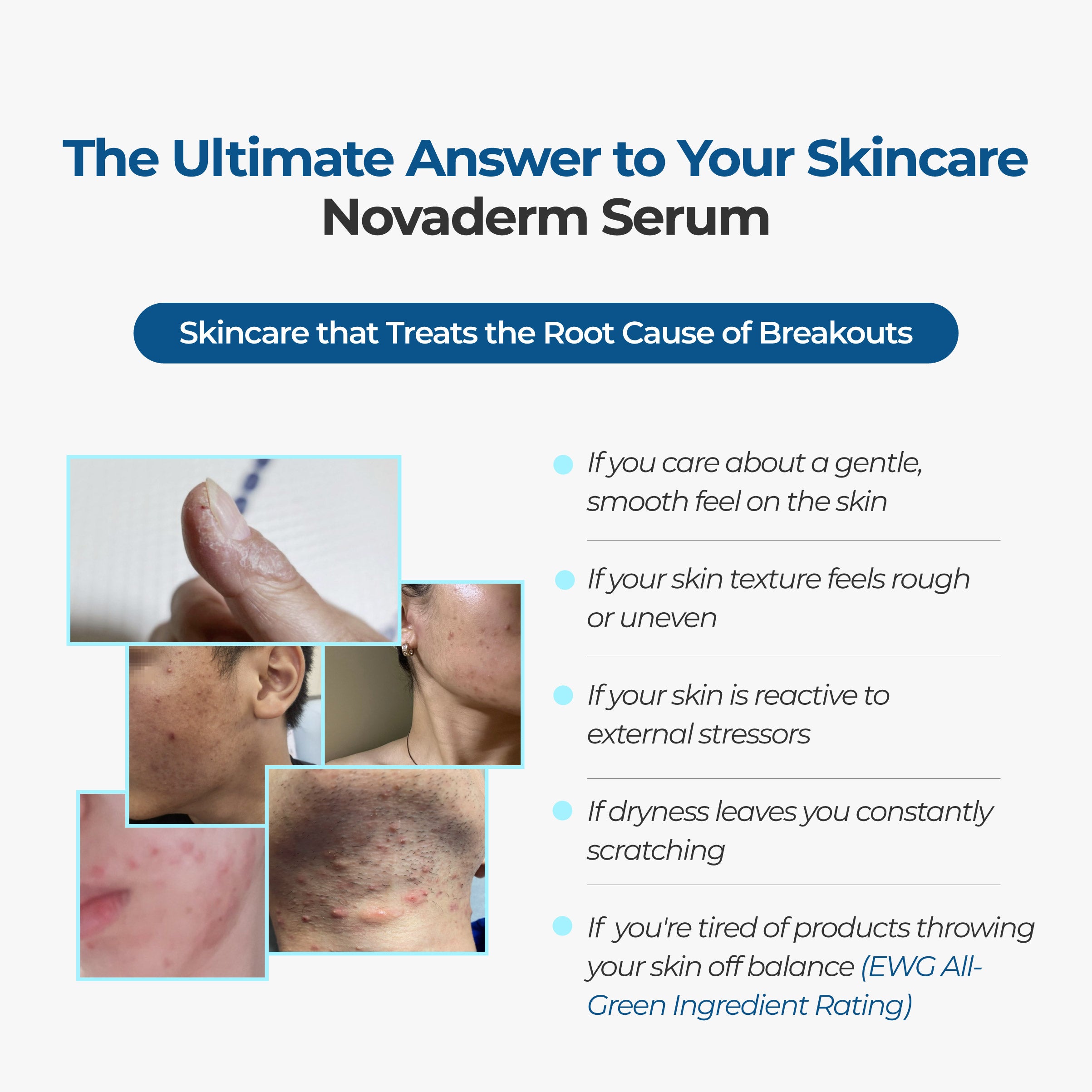 Pro-Resolving Serum